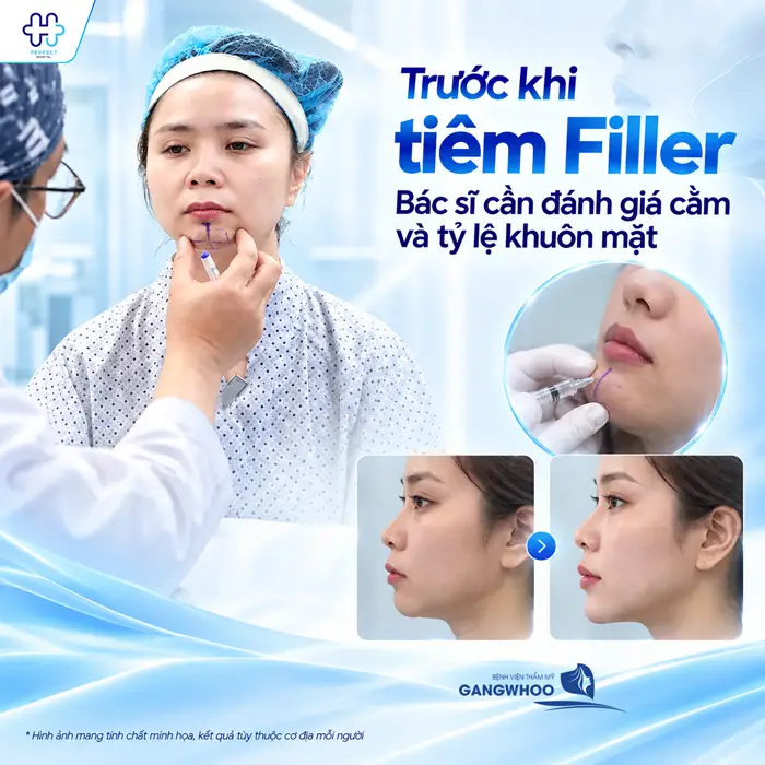 Độn Cằm Rồi Có Tiêm Filler Được Không? Bác Sĩ Giải Đáp Chi Tiết
