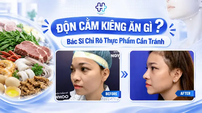 Độn Cằm Kiêng Ăn Gì? Bác Sĩ Chỉ Rõ Thực Phẩm Cần Tránh