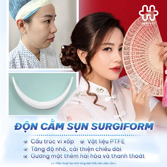 Độn Cằm Sụn Surgiform: Giải Pháp Tạo Đường Nét Cằm Tự Nhiên