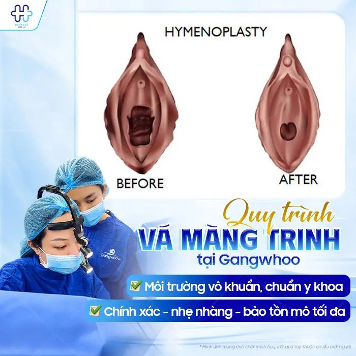Vá Màng Trinh Khi Đã Quan Hệ Nhiều Lần? Bác Sĩ Chia Sẻ