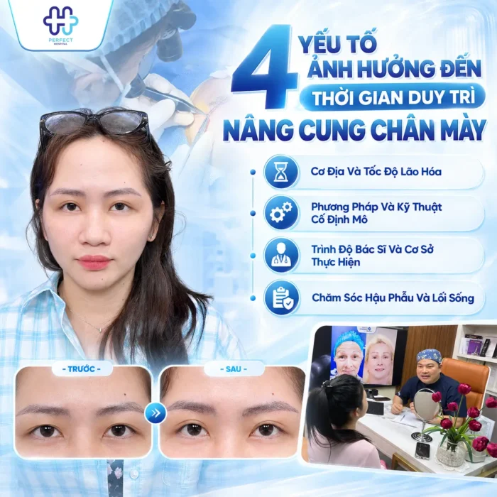 Nâng Cung Chân Mày Giữ Được Bao Lâu? Thời Gian Thực Tế Và 4 Yếu Tố Quyết Định