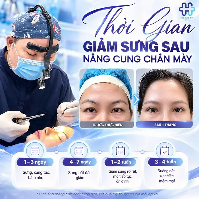 Nâng Cung Chân Mày Bao Lâu Thì Hết Sưng? Giải Đáp Chi Tiết Theo Từng Giai Đoạn