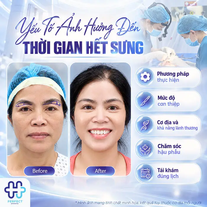 Nâng Cung Chân Mày Bao Lâu Thì Hết Sưng? Giải Đáp Chi Tiết Theo Từng Giai Đoạn