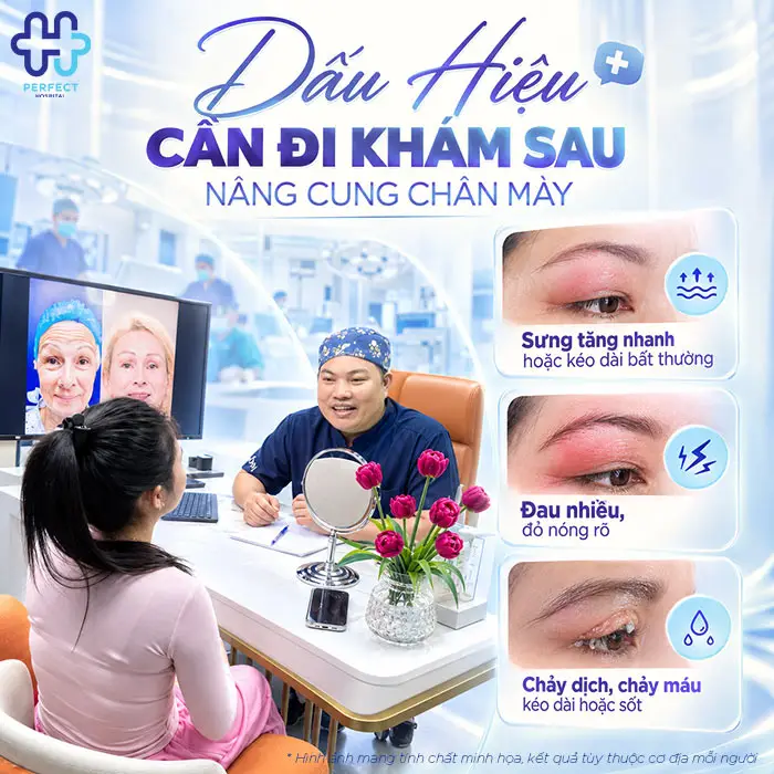 Nâng Cung Chân Mày Bao Lâu Thì Hết Sưng? Giải Đáp Chi Tiết Theo Từng Giai Đoạn