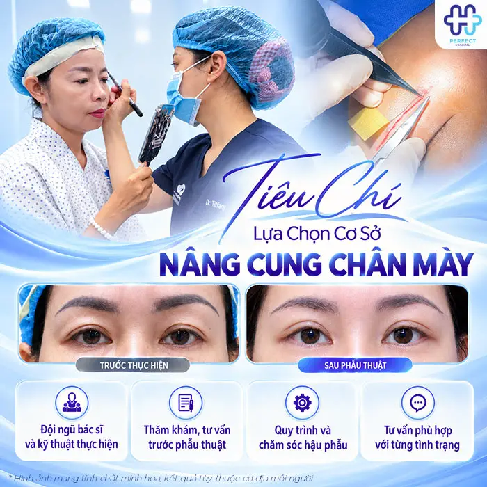 Nâng Cung Chân Mày Có Để Lại Sẹo Không? Giải Đáp Từ A-Z