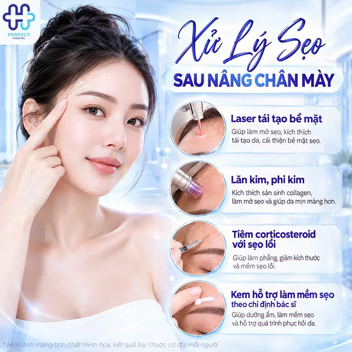 Nâng Cung Chân Mày Có Để Lại Sẹo Không? Giải Đáp Từ A-Z