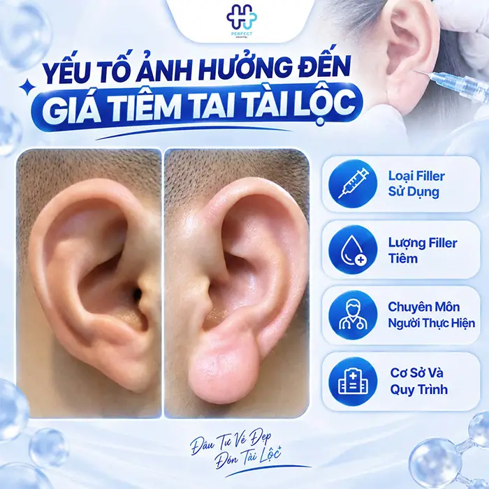 Tiêm Tai Tài Lộc Giá Bao Nhiêu? Bảng Giá Mới Nhất & Lưu Ý An Toàn