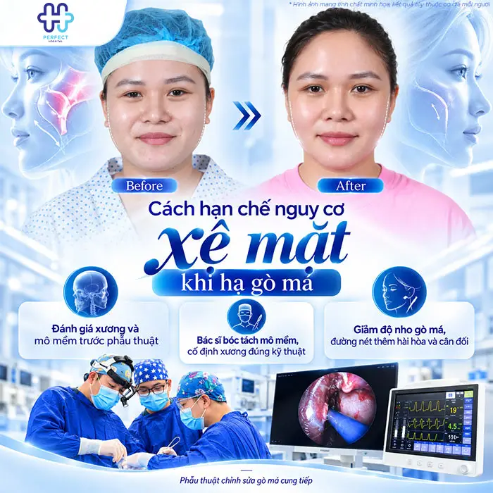 Hạ Gò Má Có Bị Xệ Mặt Không? Bác Sĩ Giải Đáp Trước Khi Phẫu Thuật