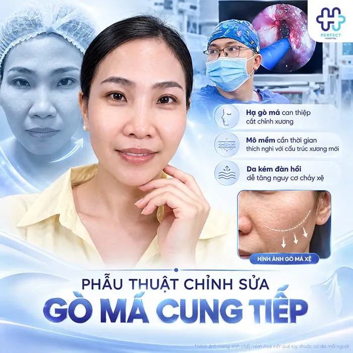 Hạ Gò Má Có Bị Xệ Mặt Không? Bác Sĩ Giải Đáp Trước Khi Phẫu Thuật