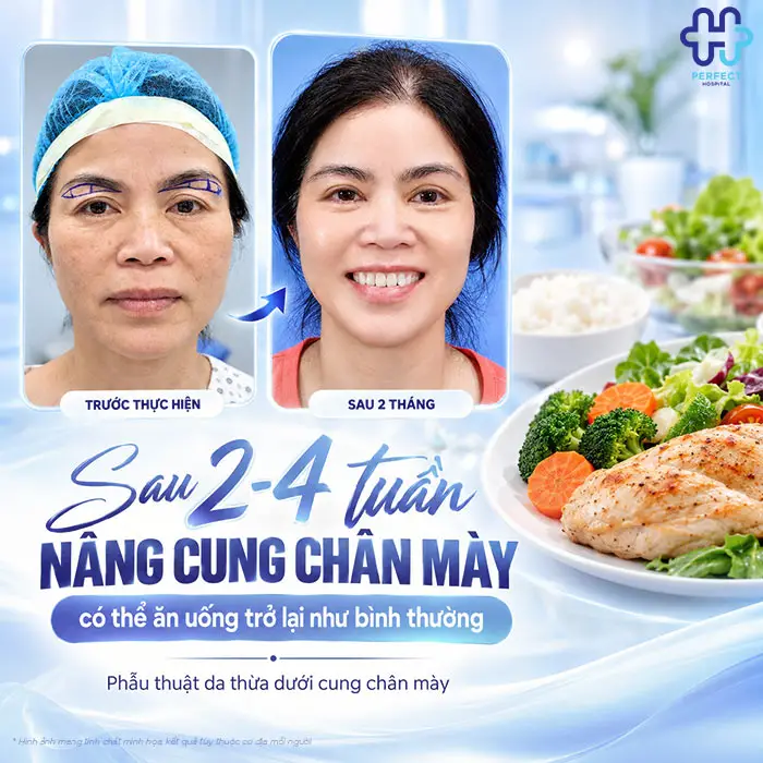 Nâng Cung Chân Mày Kiêng Ăn Gì? Hướng Dẫn Chi Tiết Từ Góc Nhìn Chuyên Khoa